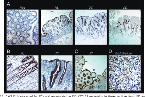 Figure From Cxcl Is A Constitutive And Inflammatory Chemokine In