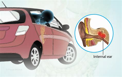 Health Condition : Symptoms, Causes, Treatment and More