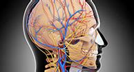 Lacunar Stroke: Symptoms, Treatments, and Long-Term Outlook