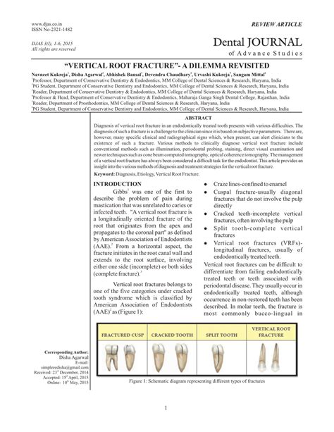 (PDF) “Vertical Root Fracture”- A Dilemma Revisited