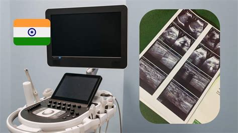 Ultrasounds In India Expat Reviews Ovale Diagnostic Centre Earth Vagabonds