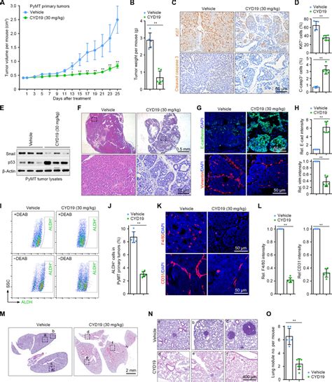 Cyd Impairs Snail Driven Tumor Progression And Pulmonary Metastasis