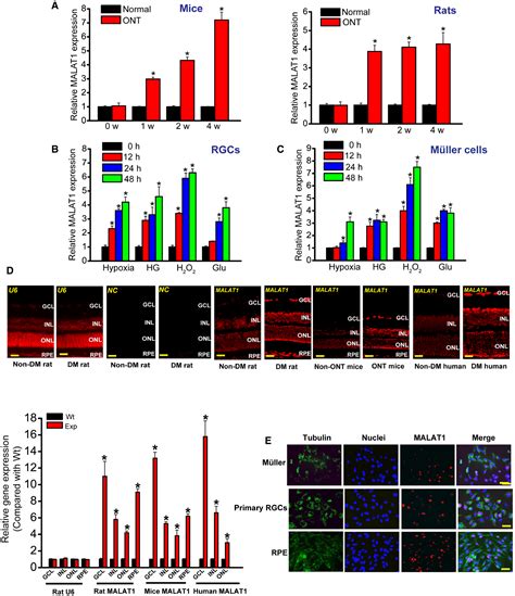 Long Noncoding RNA MALAT1 Regulates Retinal Neurodegeneration Through