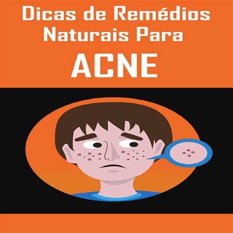 Dicas De Rem Dios Naturais Para Acne Naldo Rpg Hotmart