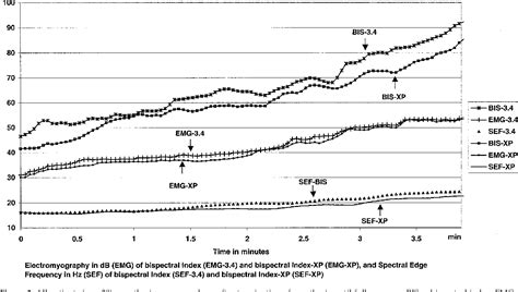 Figure From The Effect Of Different Stages Of Neuromuscular Block On