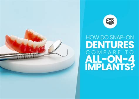 Snap On Dentures Vs All On 4 Dental Implants