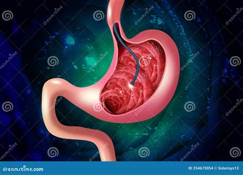 Digestive Endoscopy Or Gastroscopy Performing A Gastroscopy Procedure