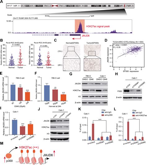 The P300mediated H3K27ac Activates JMJD6 Transcription In RCC A We