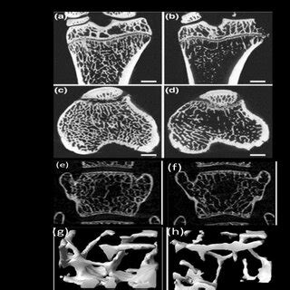 A representative images for Osteoclast markers protein expression by ...