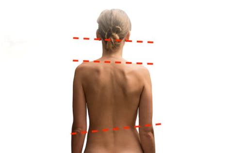 Why Your Spine Goes Out Of Alignment • Collins Chiropractic Health And Wellness Centre