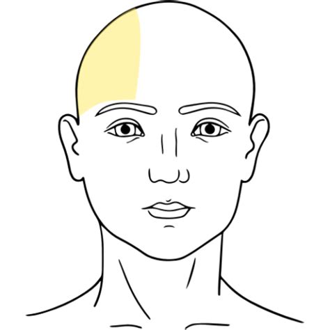 Supraorbital | Nerve Block