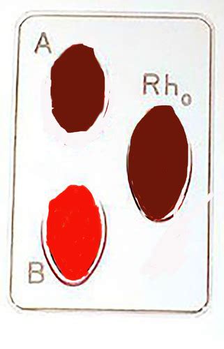 Blood Typing Lab Exam Flashcards Quizlet