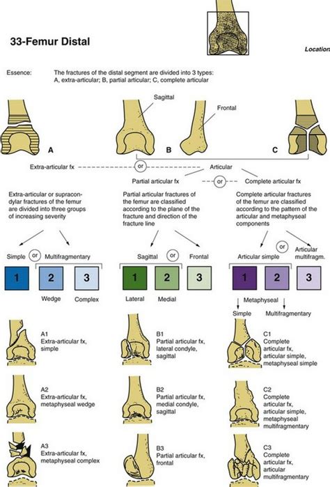 Distal Femur Fractures Musculoskeletal Key