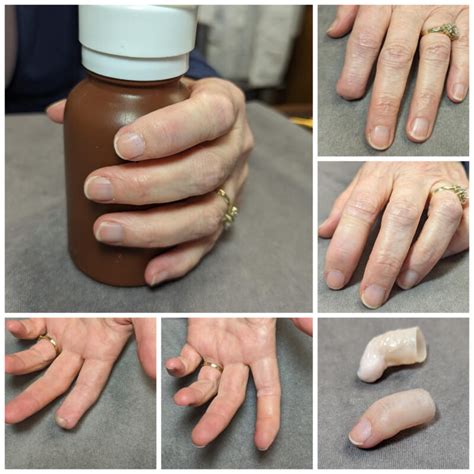 Prótese estética de dedo Lifelike Medical Art Prosthetics para adulto