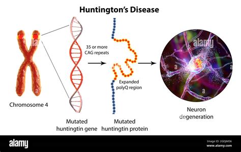 Molecular Genesis Of Huntington S Disease 3D Illustration Stock Photo