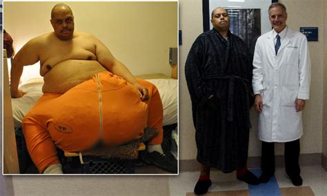 Wesley Warren Jr Man Who Had 132lbs Scrotum Removed Is Finally