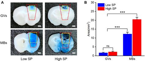 Comparison Between Fus Gvs And Fus Mbs Mediated Eb Extravasation Across