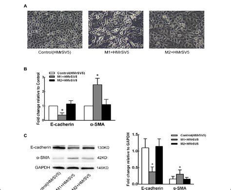 The Effects Of Direct Co Culture Of PMCs With Macrophages On EMT A