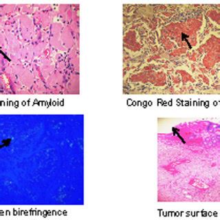 Histology slides with H&E stain, Congo Red stain, apple-green ...