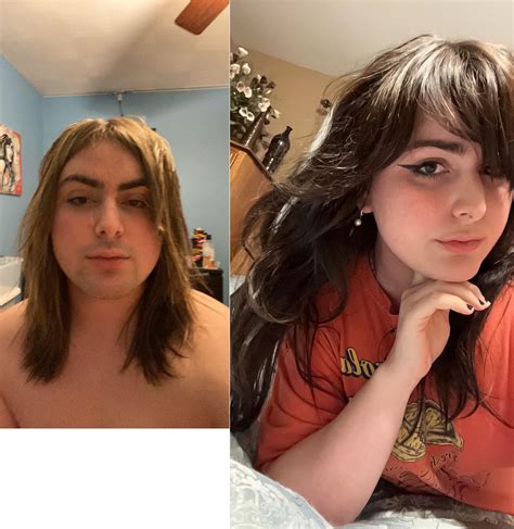 Pre Hrt Vs Now 14 Months On E Rtranstimelines