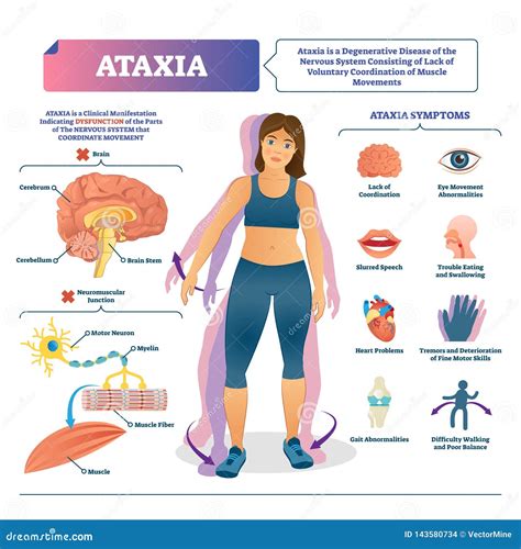 Ejemplo Del Vector De La Ataxia Esquema Médico Etiquetado Del Desorden