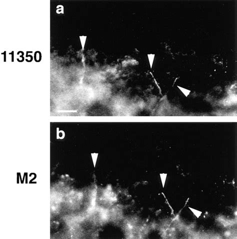 Double labeling of frozen sections of Xenopus embryos with ... 