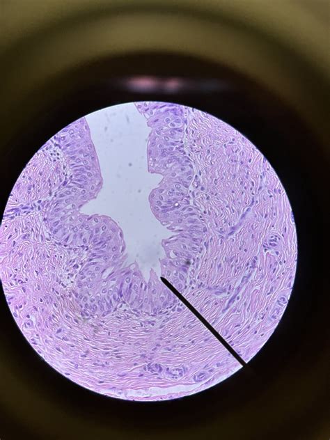 Microscope In Class Ureter Diagram Quizlet