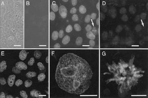 Fluorescence Immuno Labeled Cells Mounted Using Either The Standard