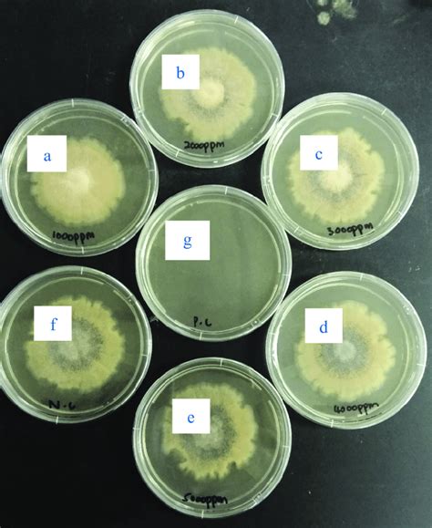 Antifungal Activity With Different Concentrations Of Aloe Vera Extract