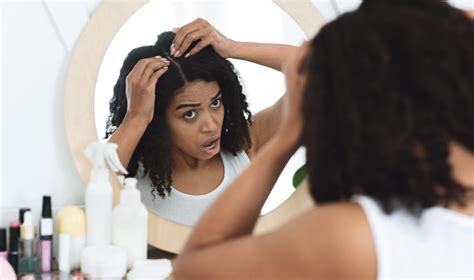 How Medications And Supplements Can Cause Hair Loss Doctall Living