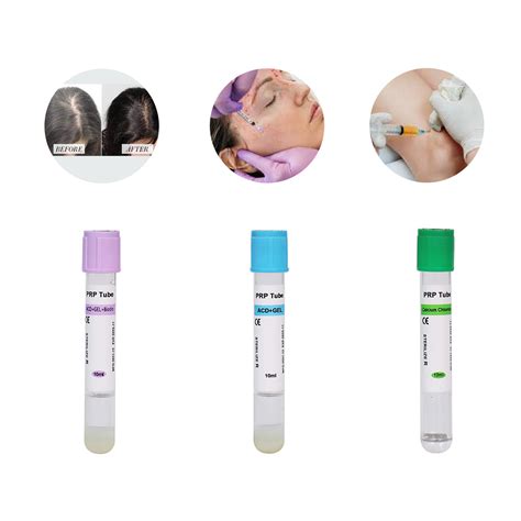 Siny Hospital Calcium Chloride Disposable Vacuum Blood Collection Tube