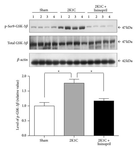 Levels Of P Ser Gsk In K C Hypertensive Rats Treated With