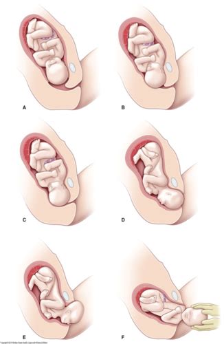 Vaginal Delivery Flashcards Quizlet