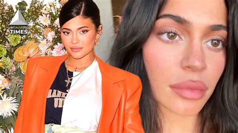 She Got Her Lip Filler Undone Kylie Jenner Regrets Her Lip Surgery