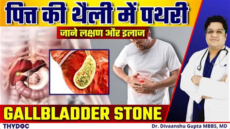 पित्त की थैली में पथरी लक्षण कारण उपचार Gallbladder Mein Pathri Hone Ke Karan Hindi Youtube