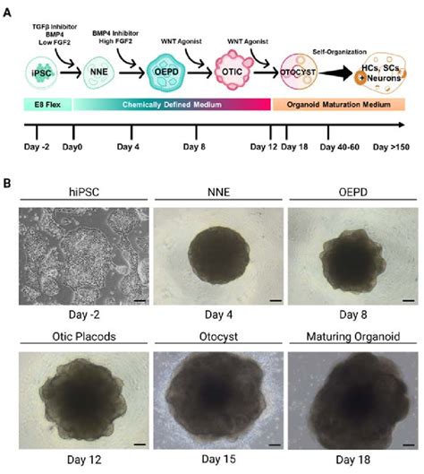 Generation Of Inner Ear Organoids From HPSCs Modified From Nie And