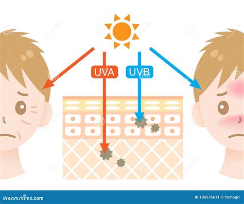 Diagram of Uva and Uvb Penetration into Human Skin with Manâs Face