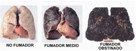 Efectos Nocivos Del Cigarrillo Para Tu Salud