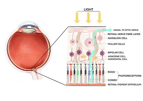 Rpe Retinal Degeneration For Patients Gene Vision