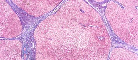 Fibrosis Imaging Drs Daylight Solutions