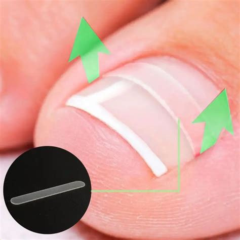 Pegatinas de corrección para las uñas de los pies calcomanías curvadas