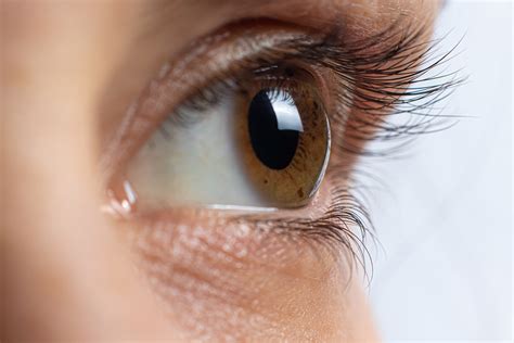 Eye Care Series Symptoms Of Keratoconus Swagel Wootton Eye Institute