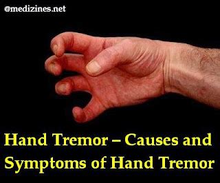 Hand Tremor Causes And Symptoms Of Hand Tremor