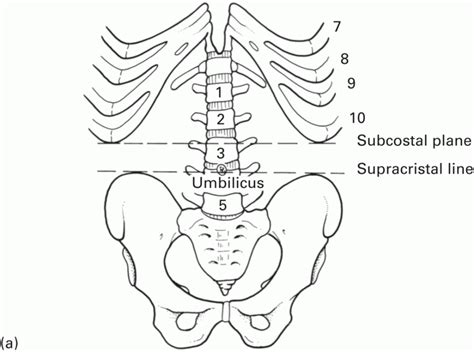 Subcostal Plane