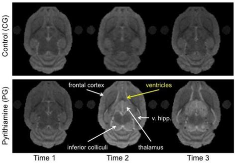 Exemplary Mri Images From A Cg Rat And A Pg Rat At The 3 Scan Time