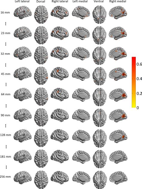 Correlations Of CTh And IIEF Score When Controlling For Age And Global