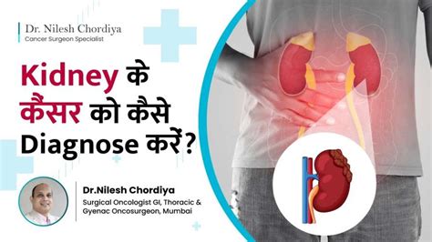 Kidney Cancer Diagnosis and Treatment | Dr Nilesh Chordiya