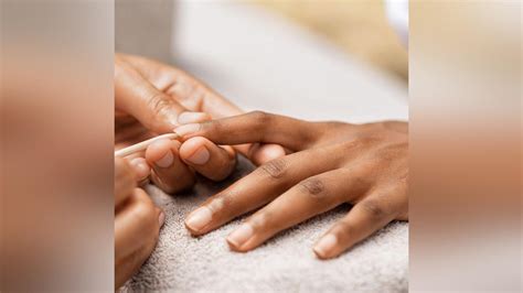 Dermatologie Ongles Cassants Quelles Sont Les Causes Gabon