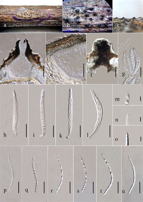 Ceratosphaeria Yunnanensis Facesoffungi Number Fof 10583 Faces Of Fungi