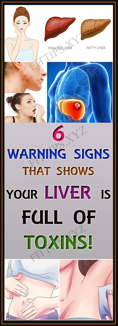 These 6 Warning Signs Show That Your Liver Is Full Of Toxins Liver